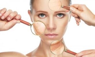 Masalah kulit apa yang dapat diatasi dengan peremajaan fraksional laser